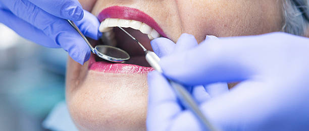 Best Emergency Treatment for Dental Infections or Abscesses in Stratford, TX